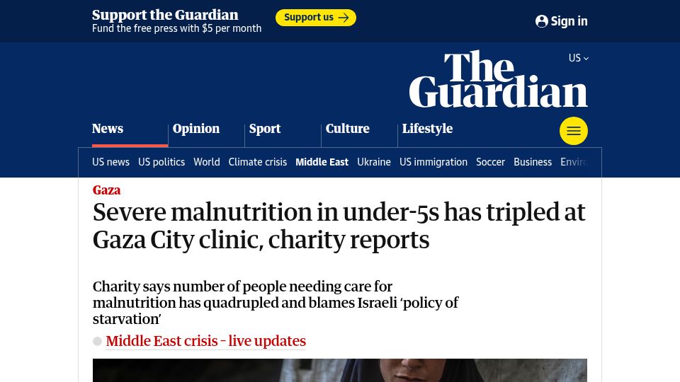 Screenshot of theguardian.com: Malnutrition in under-5s has tripled at Gaza City clinic, charity reports