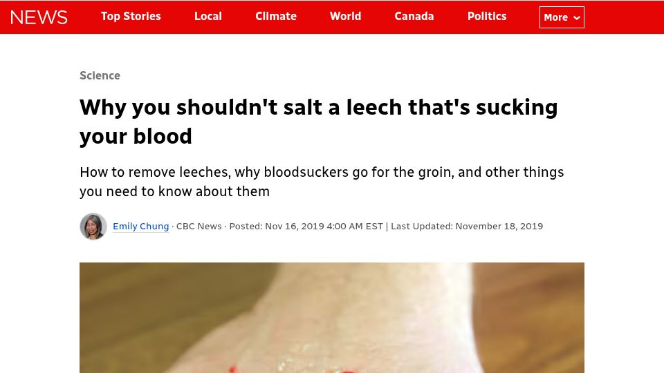 Screenshot of cbc.ca: You shouldn't salt a leech that's sucking your blood (2019)