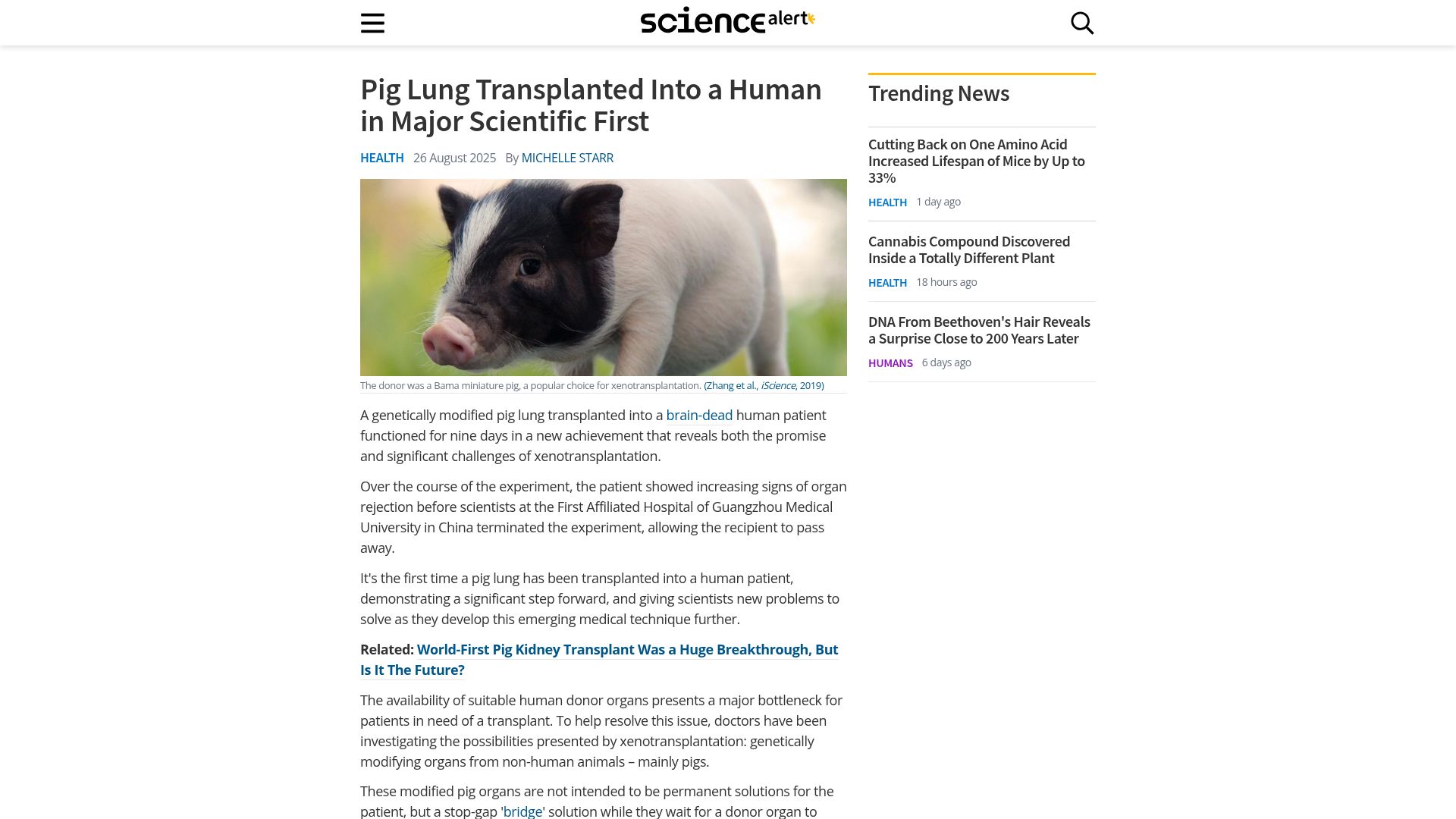 Screenshot of sciencealert.com: Pig lung transplanted into a human