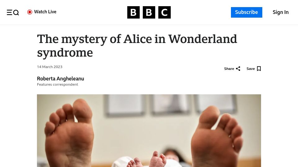 Screenshot of bbc.com: The mystery of Alice in Wonderland syndrome
