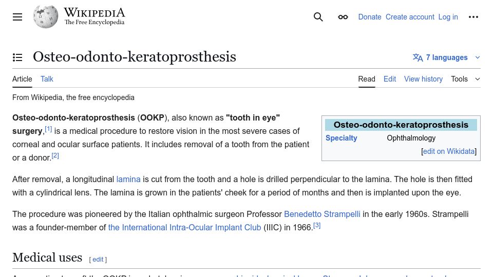 Screenshot of en.wikipedia.org: Osteo-Odonto-Keratoprosthesis