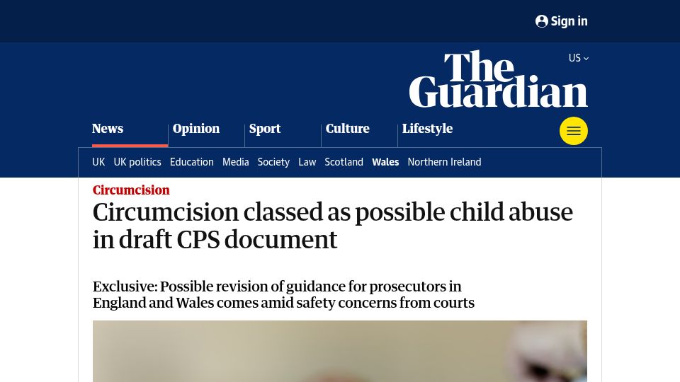 Screenshot of theguardian.com: Circumcision classed as possible child abuse in draft CPS document