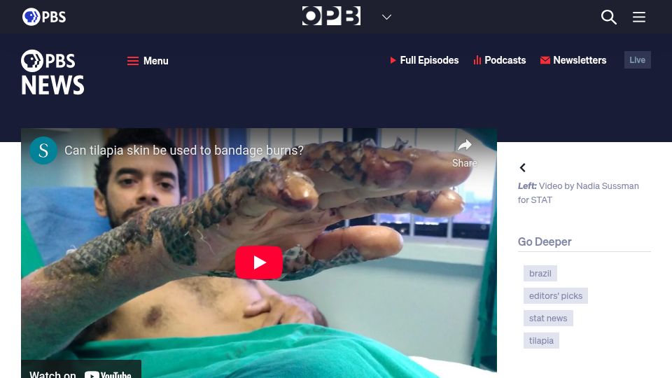 Screenshot of pbs.org: Doctors in Brazil using tilapia fish skin to treat burn victims (2017)