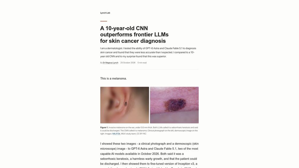 Screenshot of lynchlab.net: A 10-year-old CNN outperforms frontier LLMs for skin cancer diagnosis