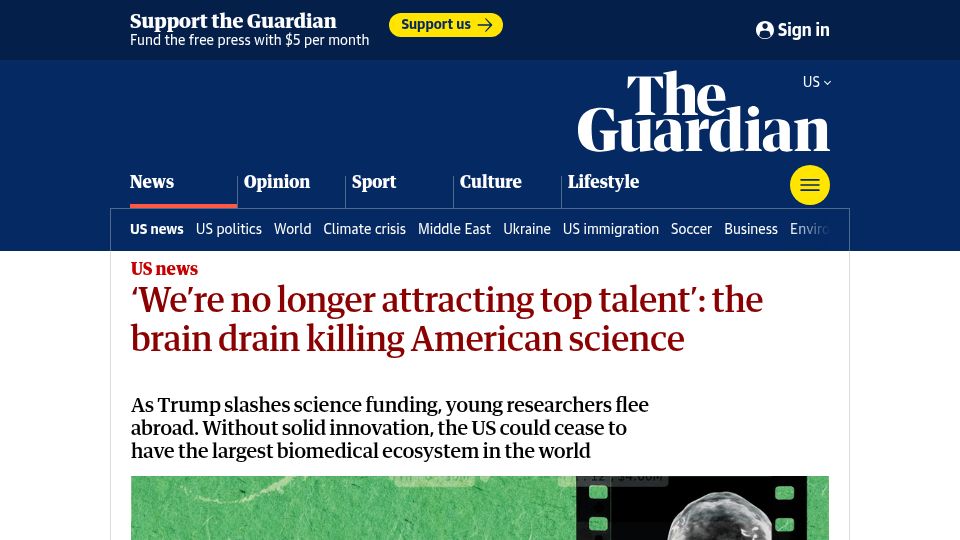 Screenshot of theguardian.com: We're no longer attracting top talent: the brain drain killing American science