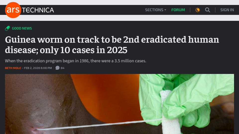 Screenshot of arstechnica.com: Guinea worm on track to be 2nd eradicated human disease; only 10 cases in 2025