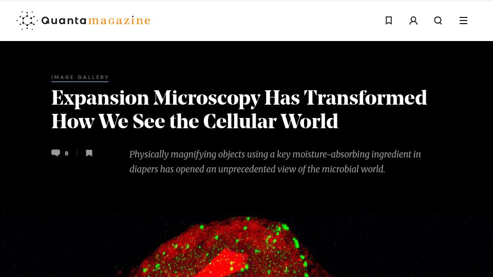 Screenshot of quantamagazine.org: Expansion Microscopy Has Transformed How We See the Cellular World