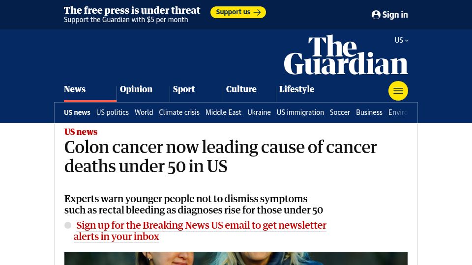 Screenshot of theguardian.com: Colon cancer now leading cause of cancer deaths under 50 in US