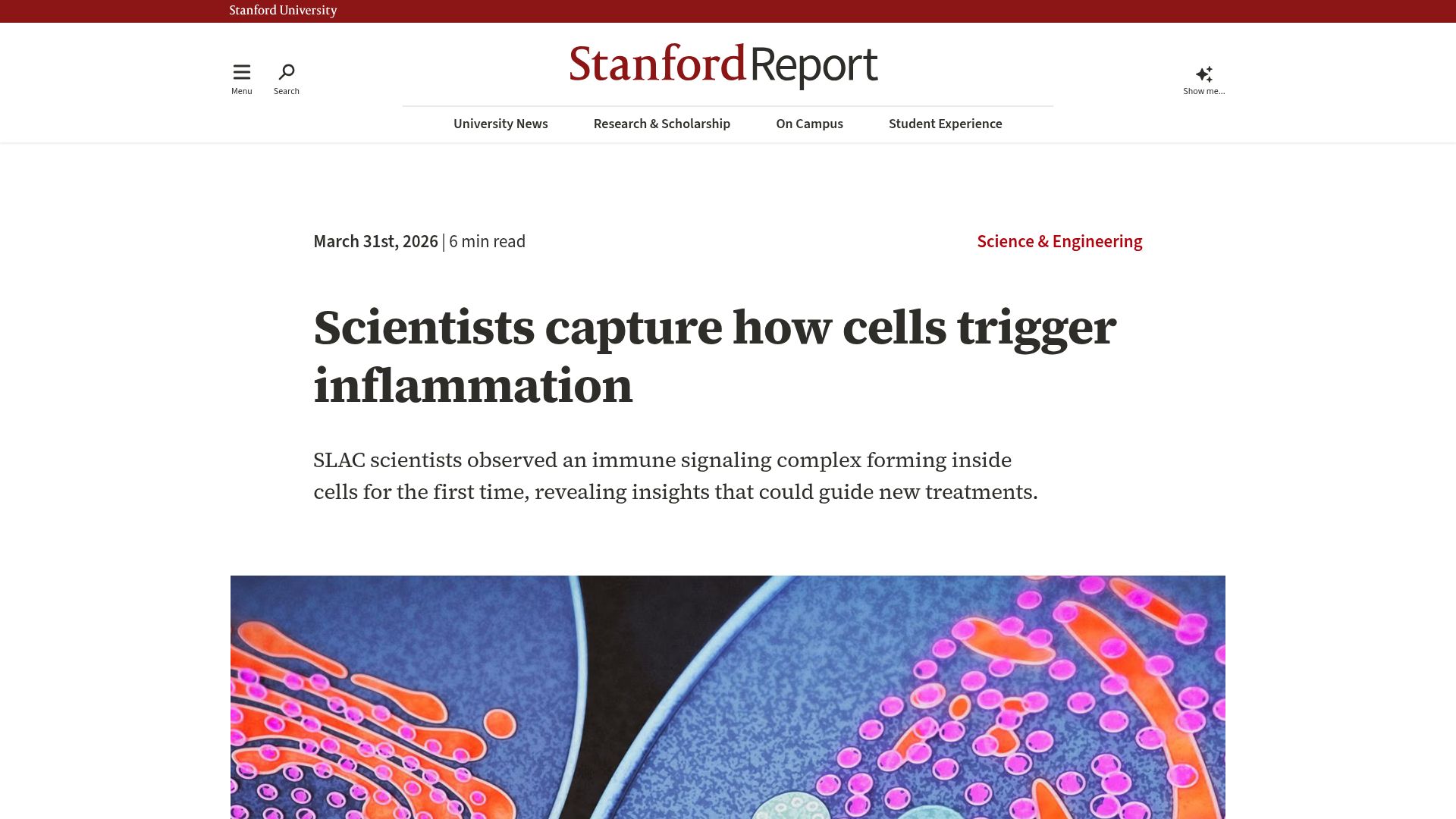 Screenshot of news.stanford.edu: Scientists observe an immune signaling complex forming inside cells