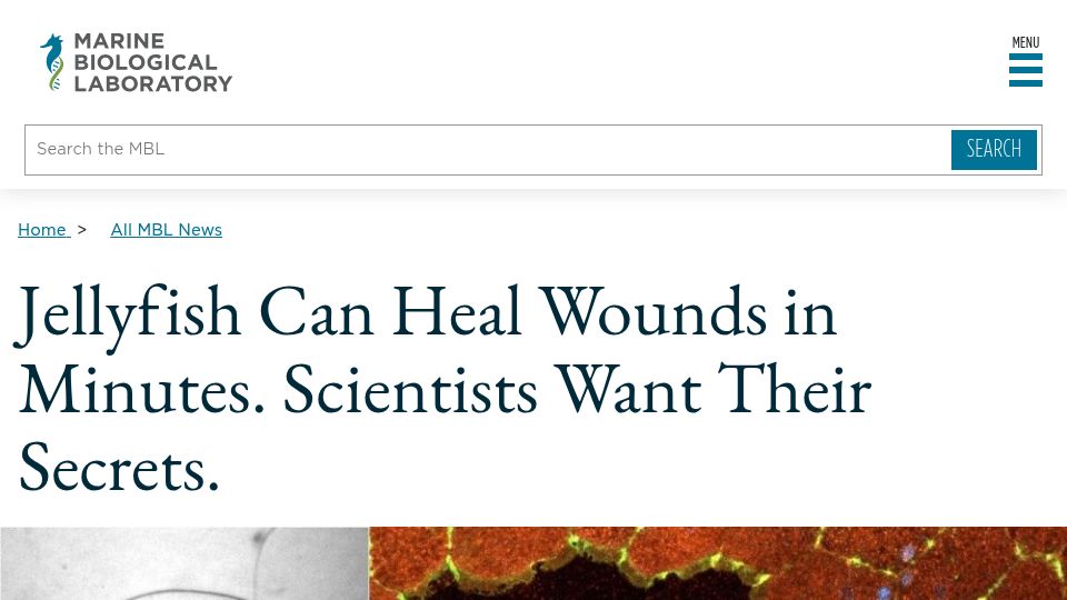Screenshot of mbl.edu: Jellyfish can heal wounds in minutes. Scientists want their secrets